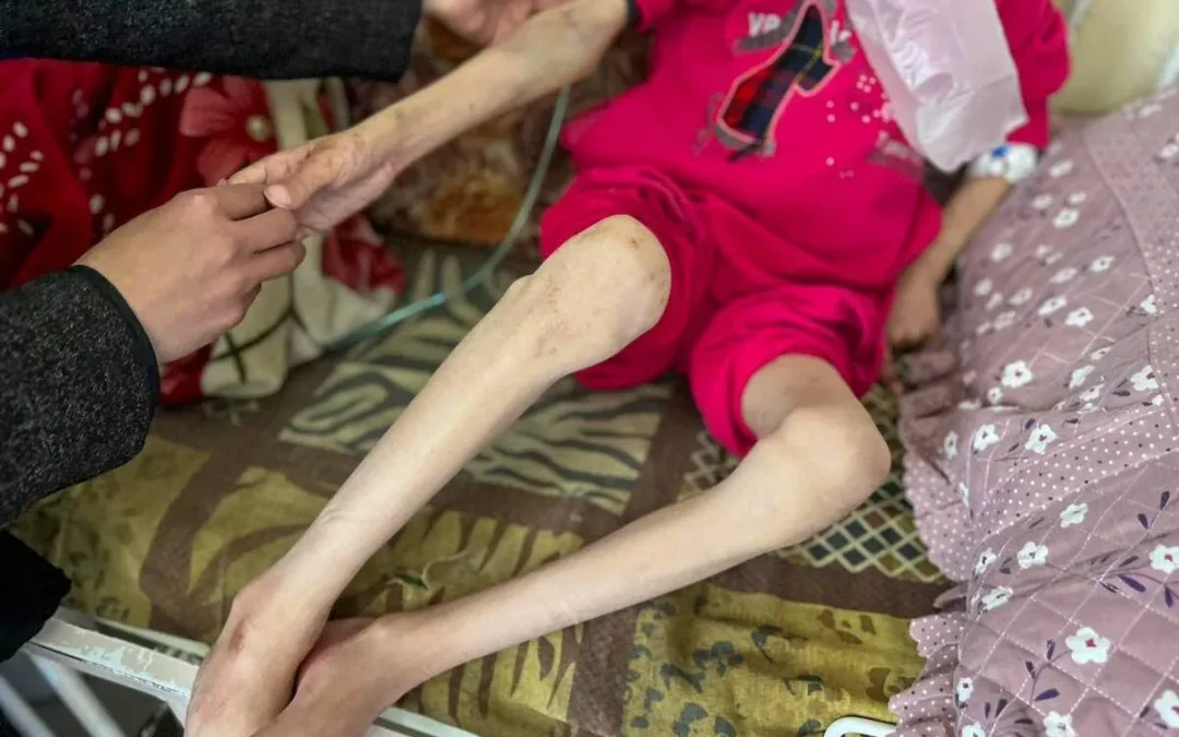 Israel sending more children ‘to their graves’ after denying food aid to northern Gaza