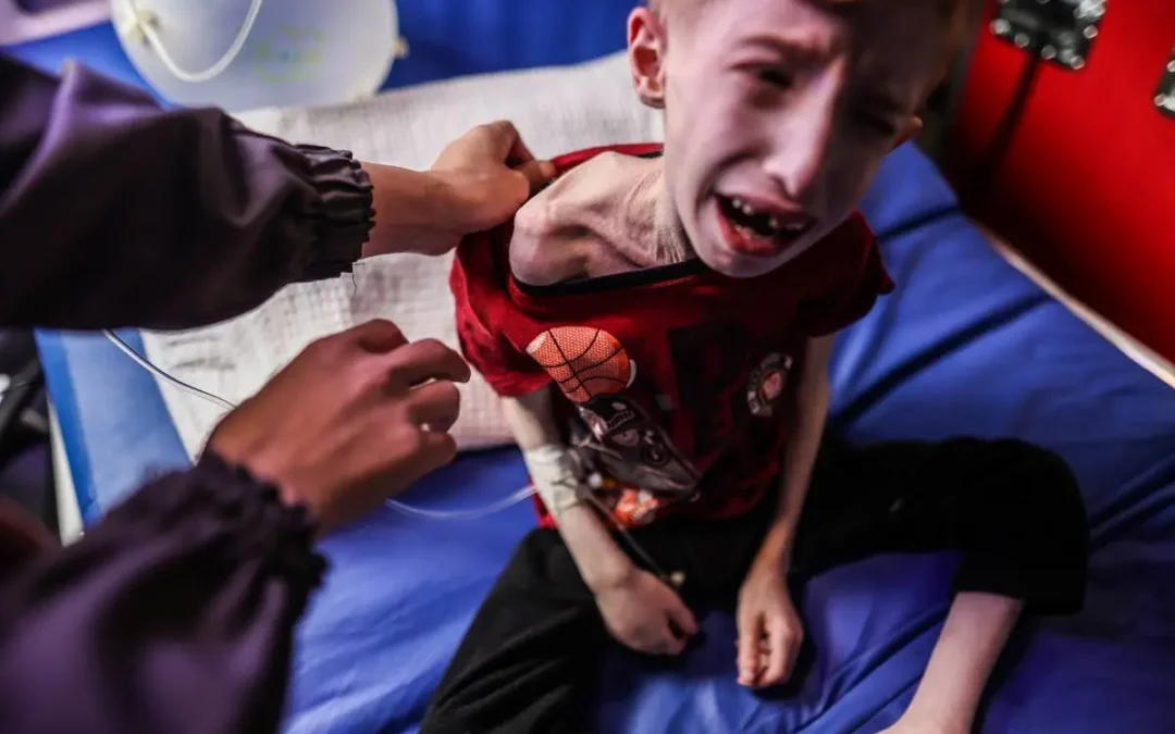 UNRWA chief warns man-made famine tightening grip across Gaza