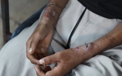 Israel finds harsh conditions for Palestinian detainees at notorious Sde Teiman Prison